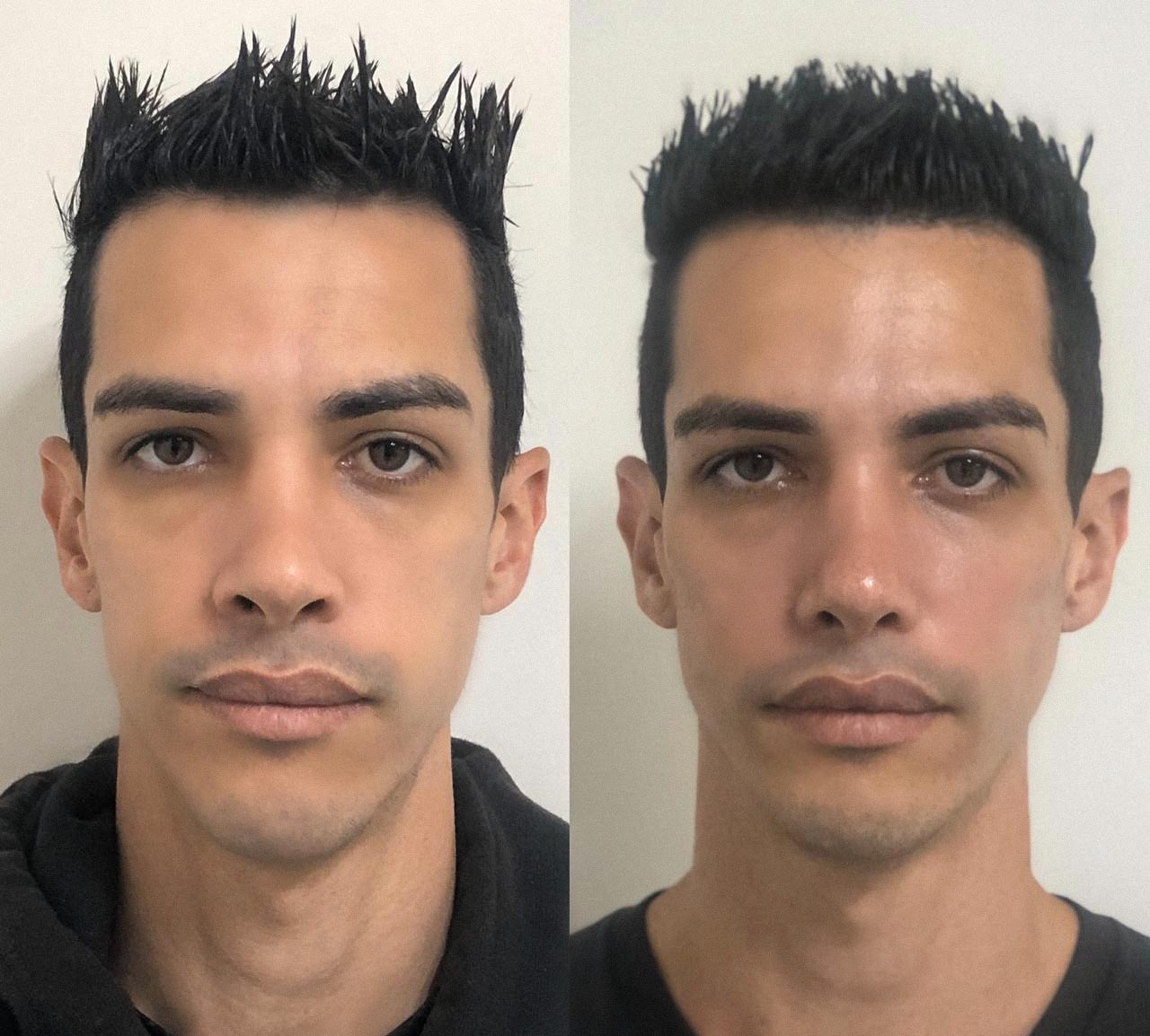 rosto mais jovem naturalmente