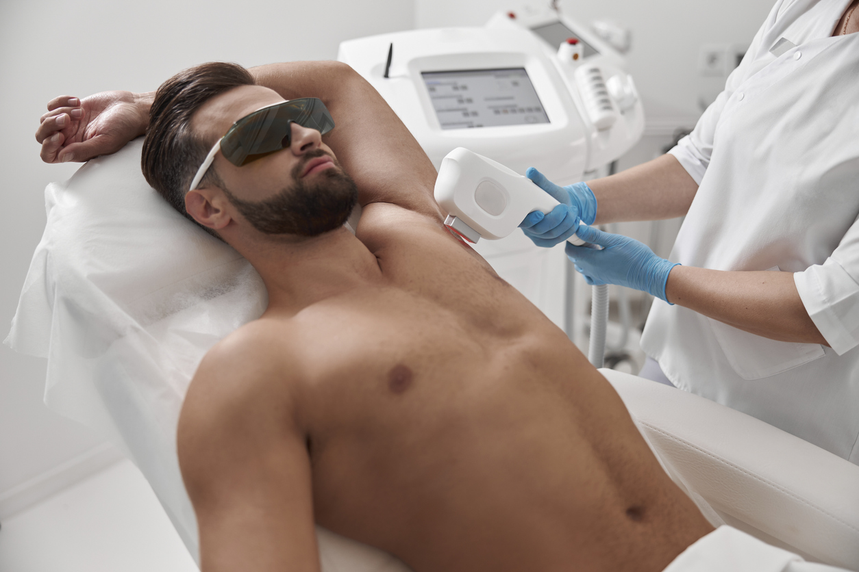 depilação a laser em casa para homens
